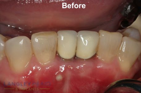 before patient surgery