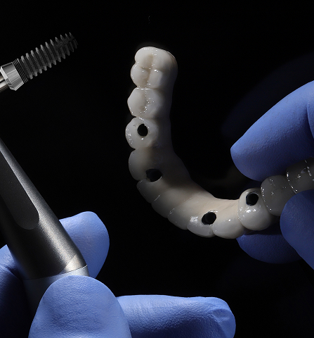implant denture
