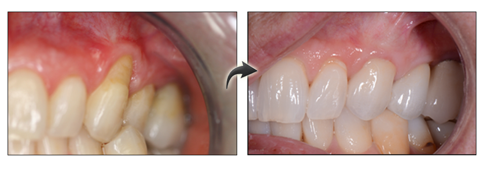 real patient results