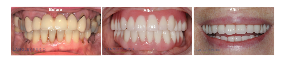 real patient results picture