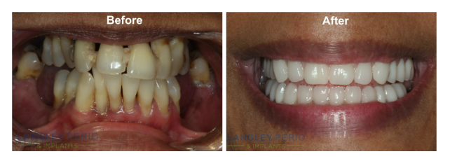 real patient result photo