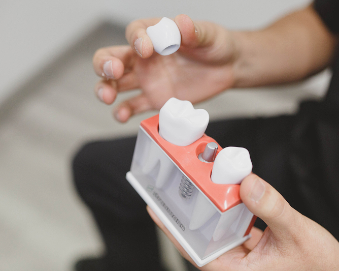dental implant model