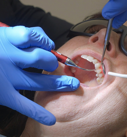 laser dentistry